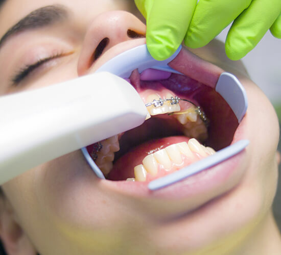 Ortodonti-Diş Teli